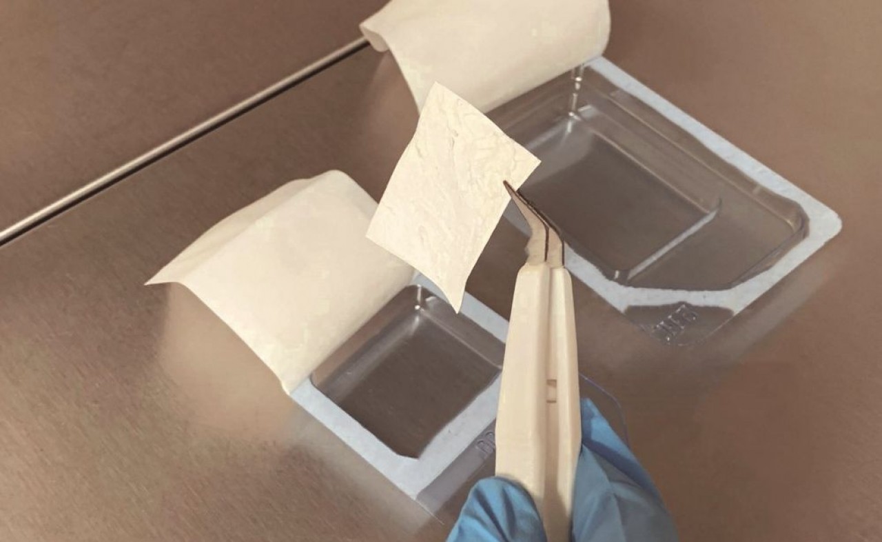 Lamina Therapeutics développe un pansement biodégradable tridimensionnel comportant des nano-réservoirs de produits actifs, associés à des cellules souches issues du patient.