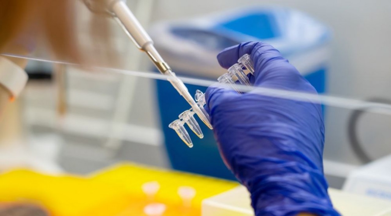 La biotech mYXpression s'appuie sur le séquençage ARNm pour identifier les biomarqueurs à traiter. © Shutterstock